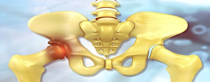 Best Hip Replacement Surgeon in Vile Parle, Mumbai